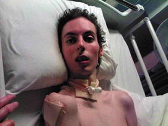 Kealan Burke receiving treatment in hospital after taking methadone.