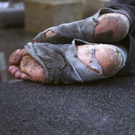 homeless-feet